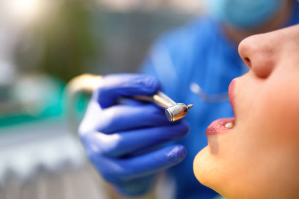 Dental Bonding in Fircrest, WA